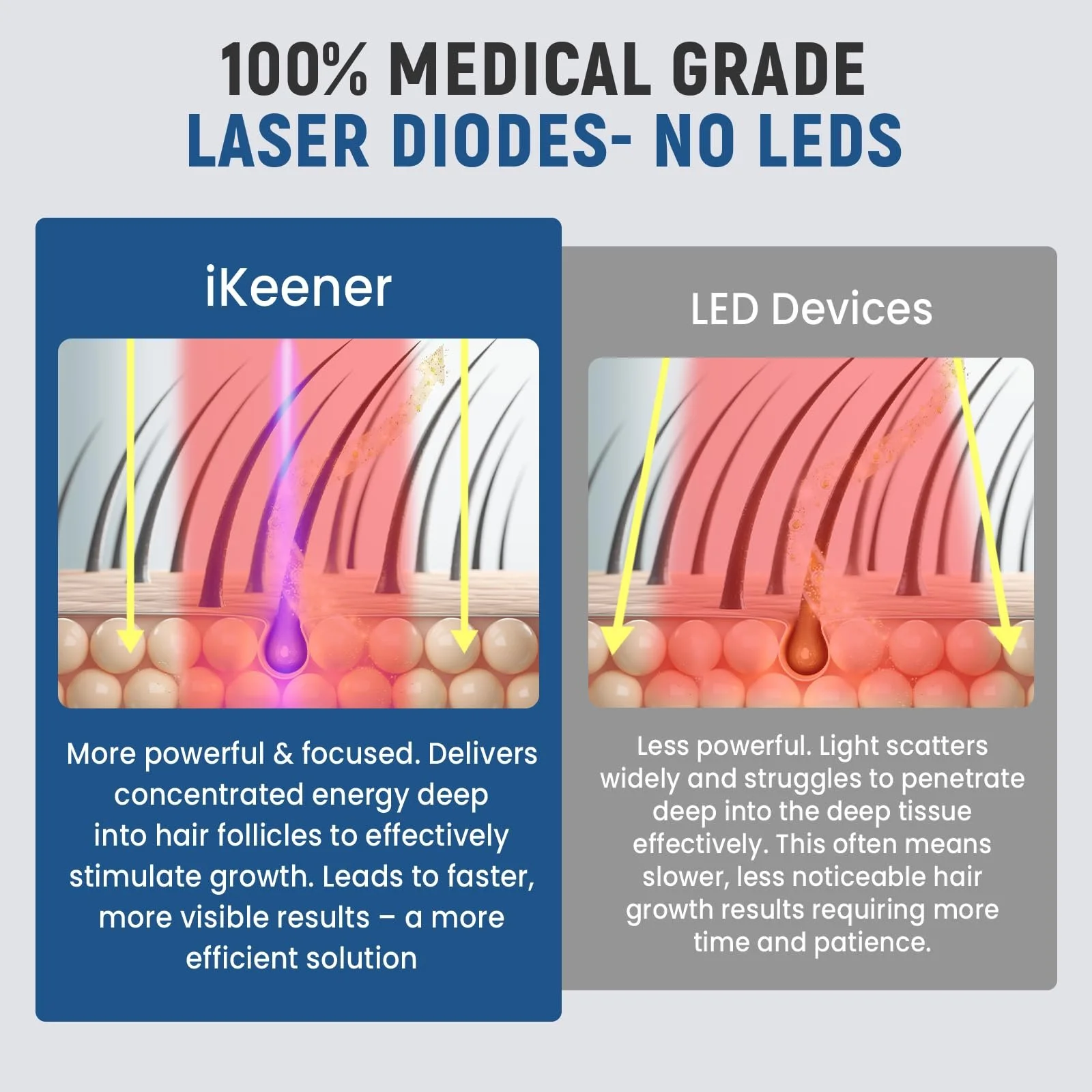 Шолом Лазерний iKeener lllt для росту волосся 109 лазерних діодів 650 нм, фото №5
