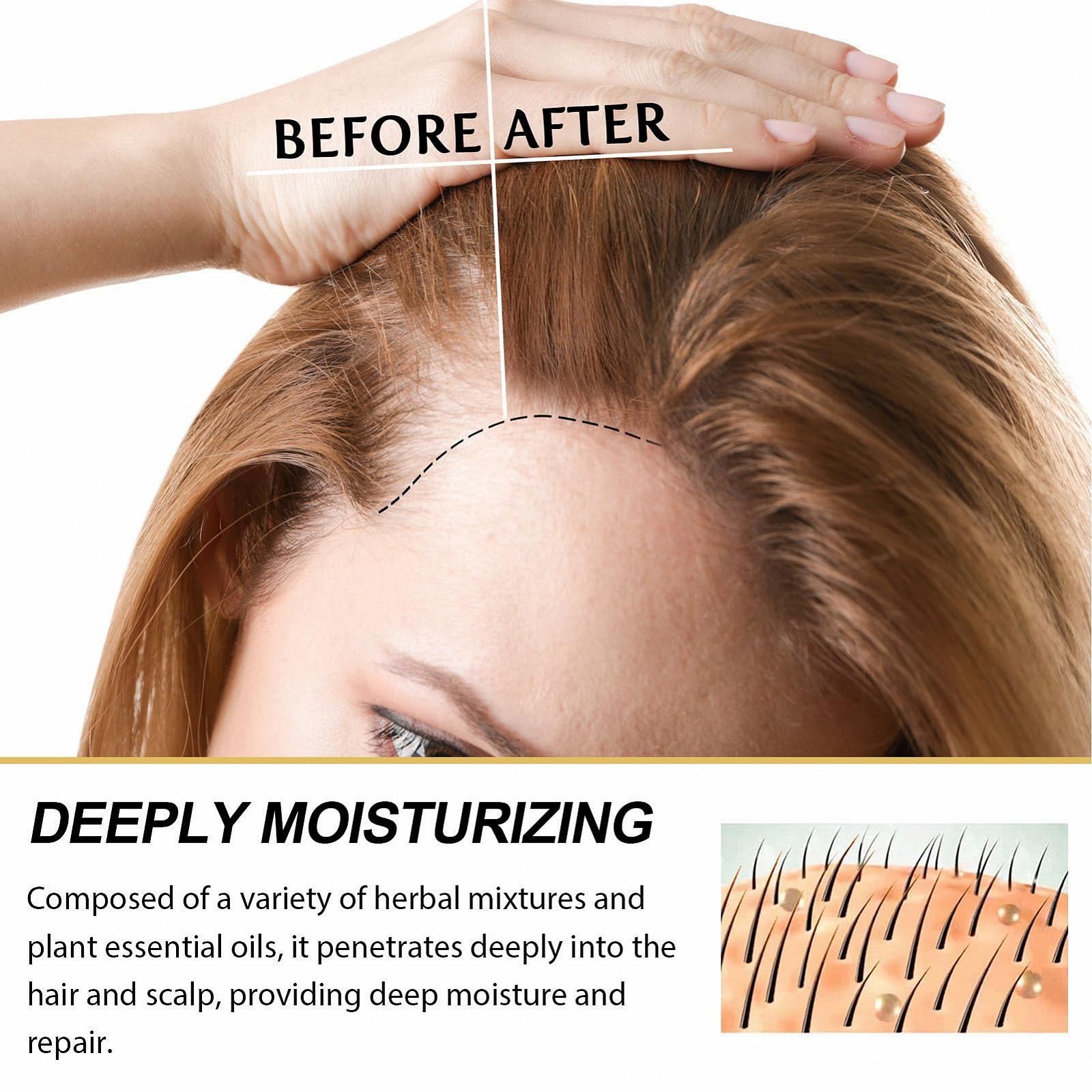 Кондиціонер для волосся Pack of 3 100 мл Поживний Ремонтуючий Зволожує суху шкіру голови, фото №8