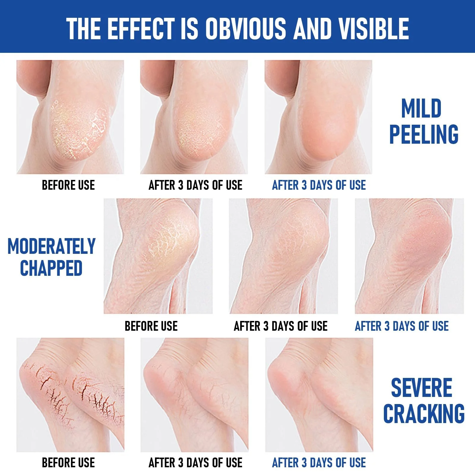 Крем-стик для ног Foot Cream для сухой кожи и трещин интенсивный против мозолей быстро впитывающийся, фото №4