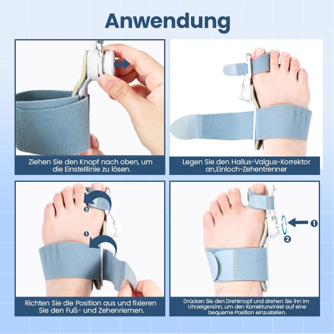 Шина для корекції Hallux Valgus, регульована, з фіксуючою пластиною та роздільником для пальців, універсальний розмір, для дня і ночі, унісекс, фото №5