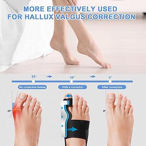 Шина для корекції Hallux Valgus, 2 x роздільники для пальців ніг, 2 x корекційні шини, регульована synthetic.ua - Фото 1