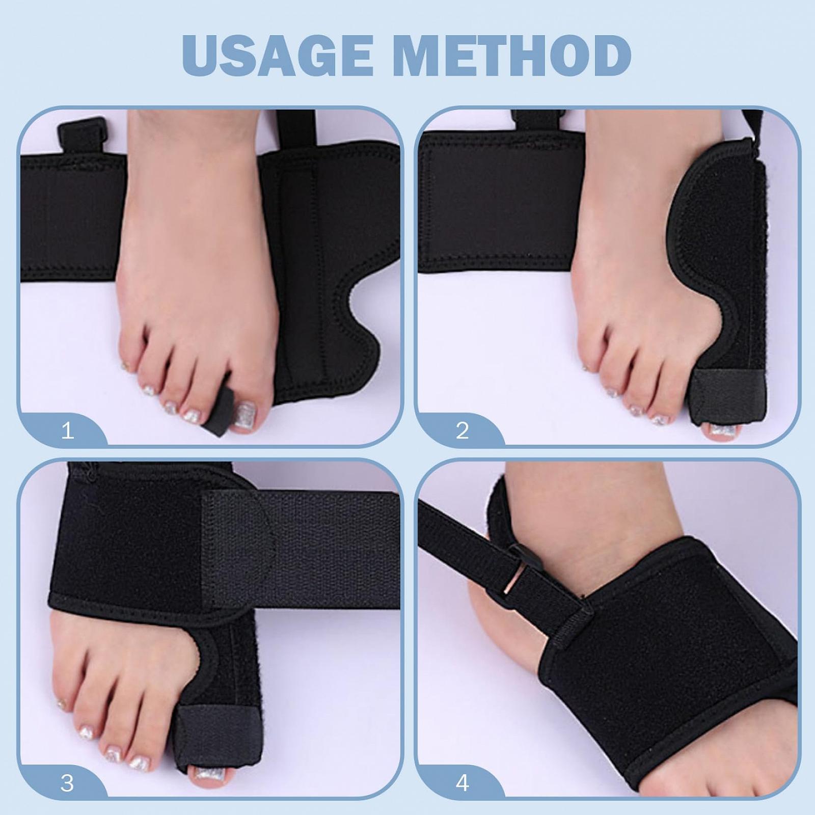 Коректор для великого пальця стопи (вальгусної деформації), 1 пара, регульований, дихаючий ортез з алюмінієвими стрижнями, фото №3