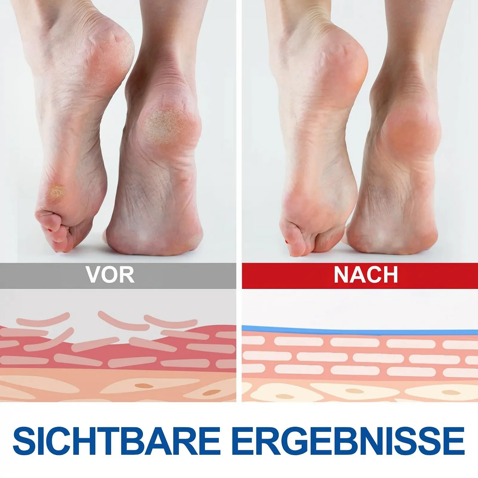 Стик-крем для ног увлажняющий против трещин, фото №8