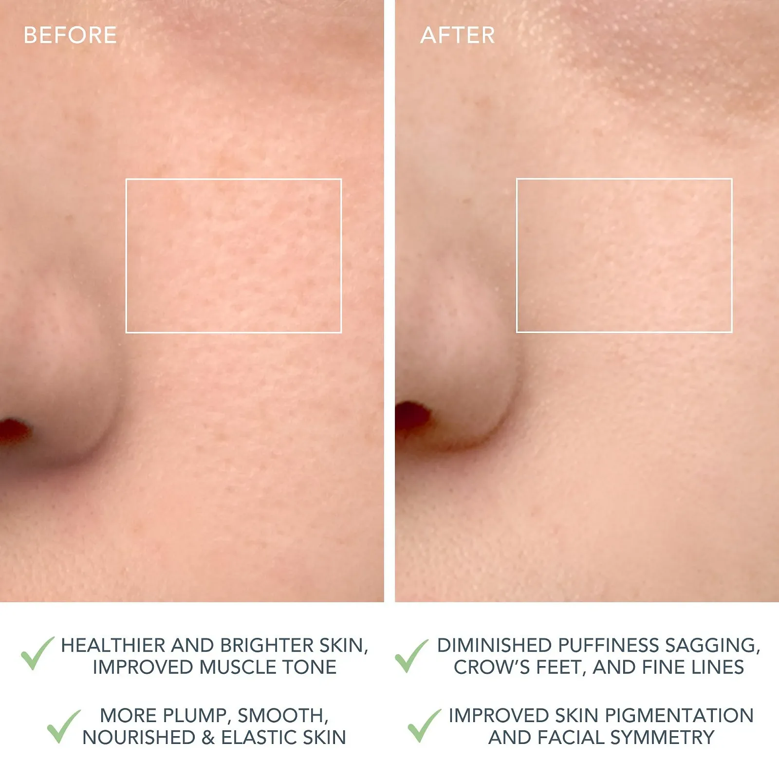 Прилад для чищення обличчя FOREO LUNA 4, фото №5