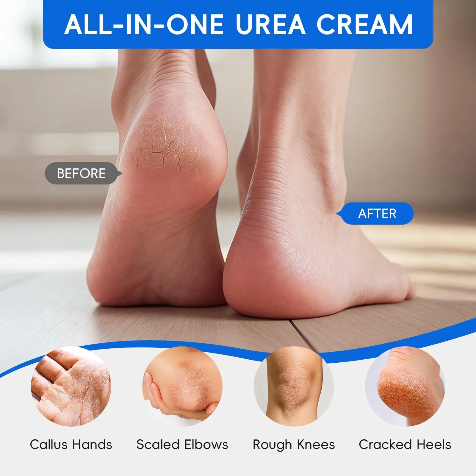 Крем для ног LAIKOU Callus Cream Feet Urea с мочевиной, фото №5