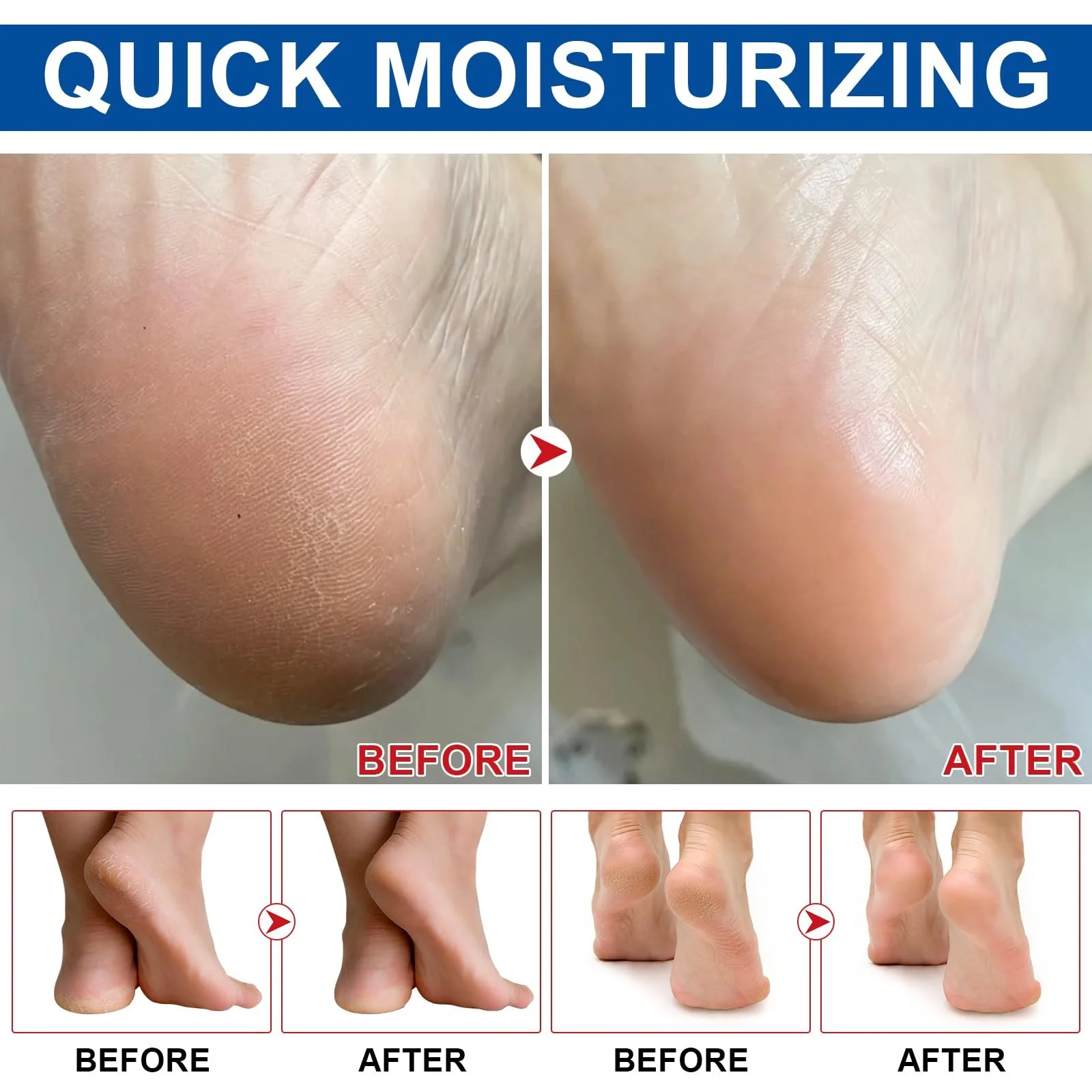 Крем для ног с мочевиной 60% для сухой и огрубевшей кожи набор из 2 шт, фото №7