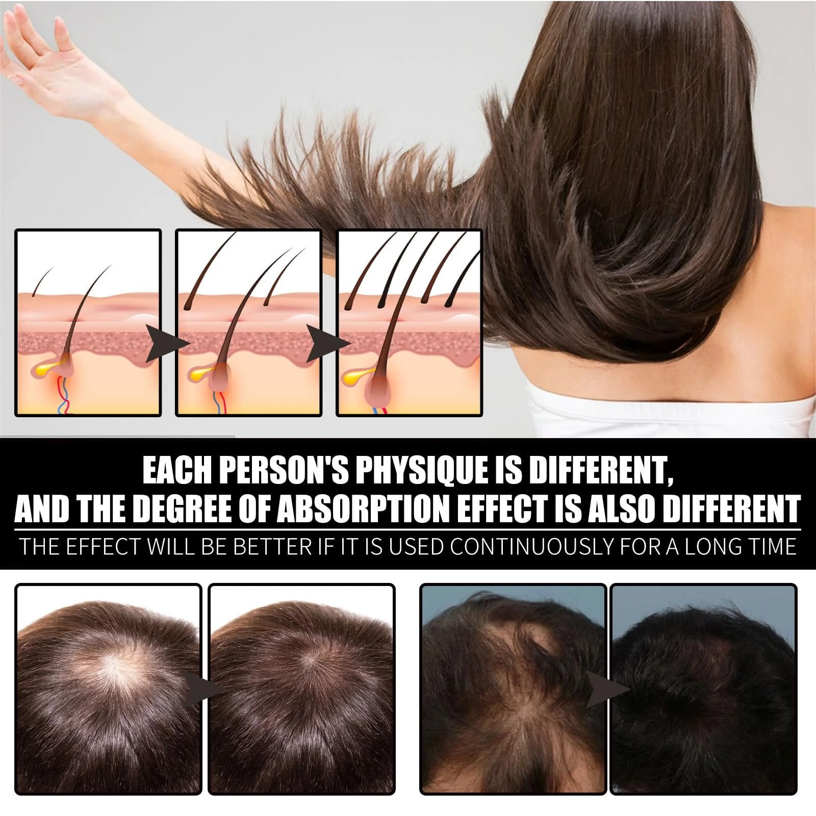 Сироватка для росту волосся, проти випадіння волосся, фото №3