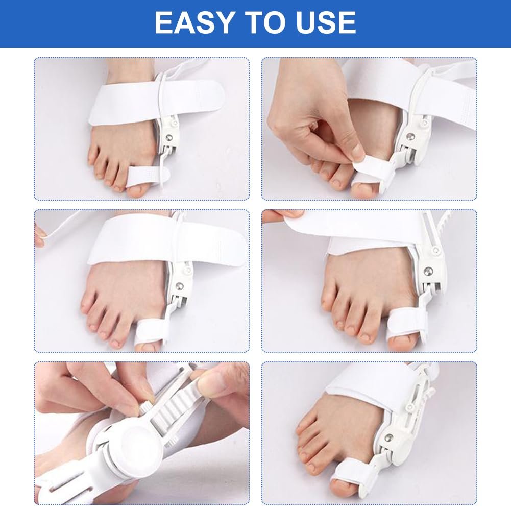 Шина для коррекции Hallux Valgus, регулируемая, фиксатор для большого пальца ноги, фото №5