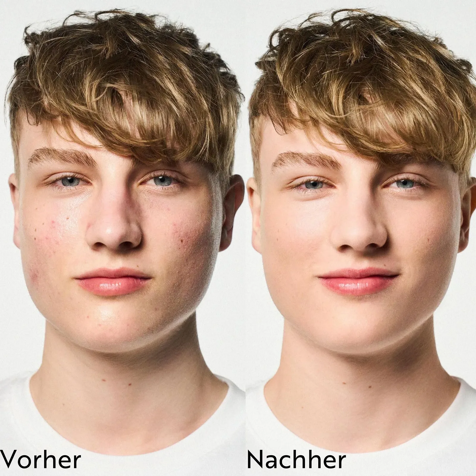 Гель для вмивання M. Asam Clear Skin 200 мл, фото №5