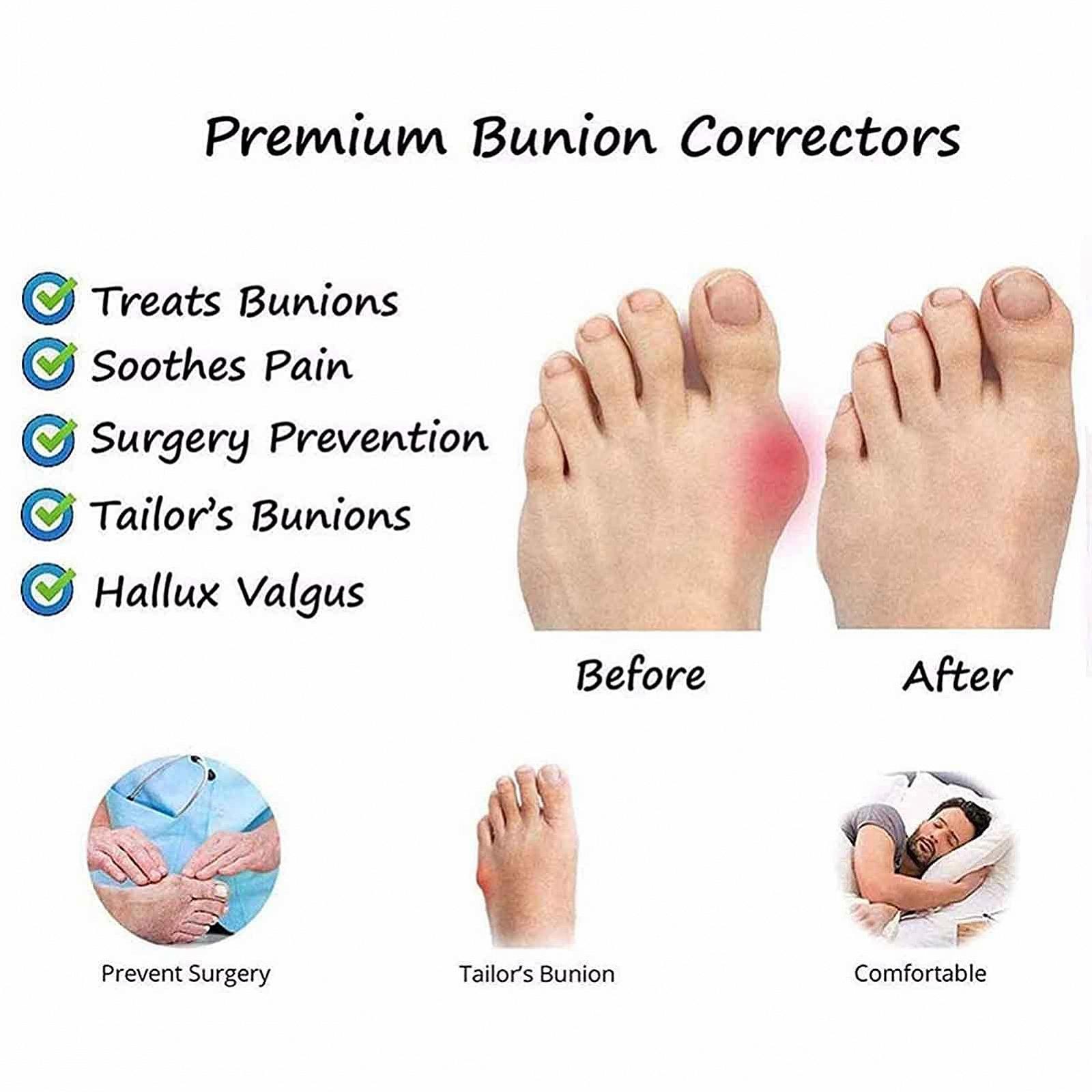 Женские Шлепанцы на платформе танкетке для коррекции вальгусной деформации, фото №6 Женские Шлепанцы на платформе танкетке для коррекции вальгусной деформации, фото №6