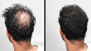 Волокна для загущення волосся LUXE з натуральним кератином Темно-коричневий synthetic.ua - Фото 1