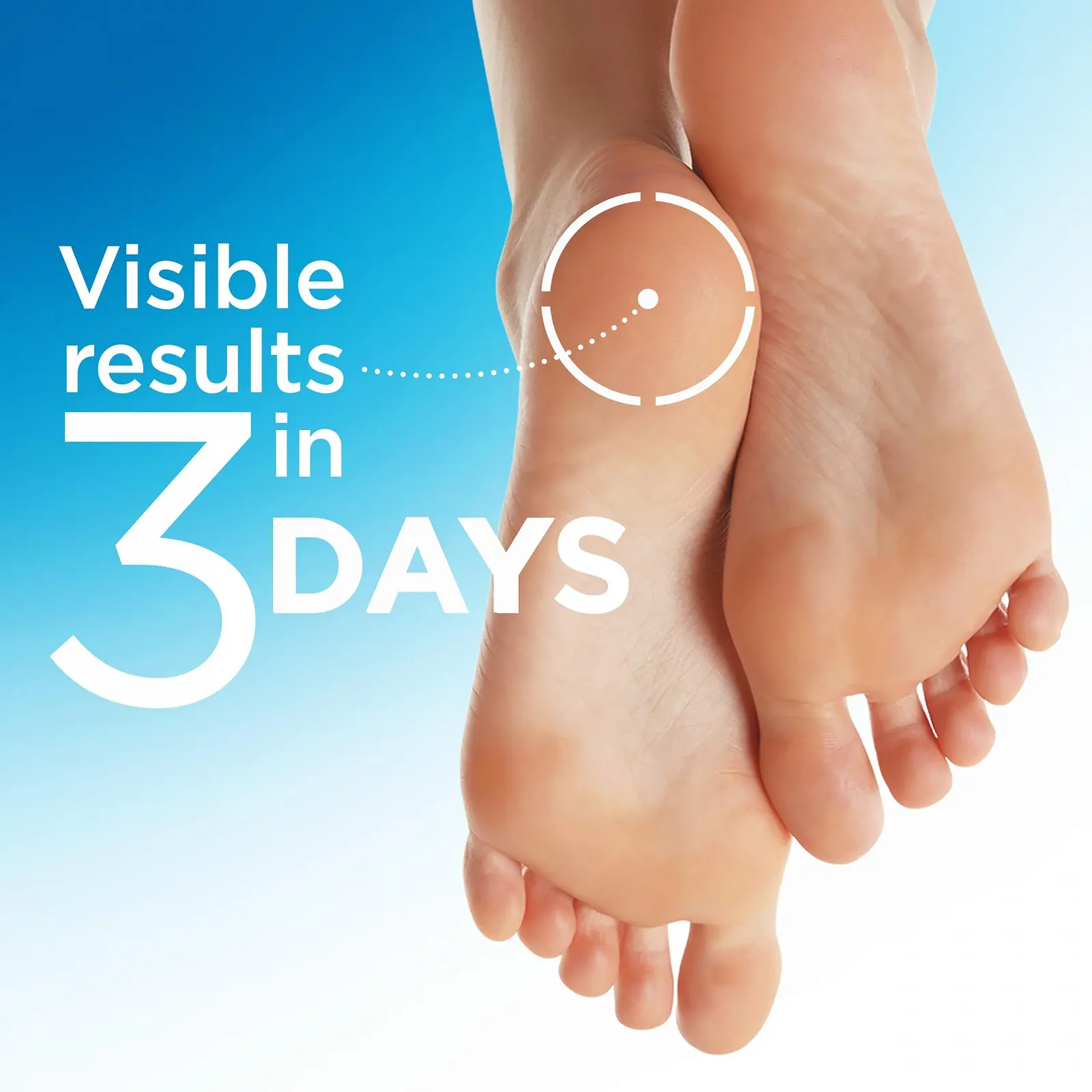 Средство для пяток Flexitol Heel Magic с маслом ши и витамином E 2,5 унции, фото №2