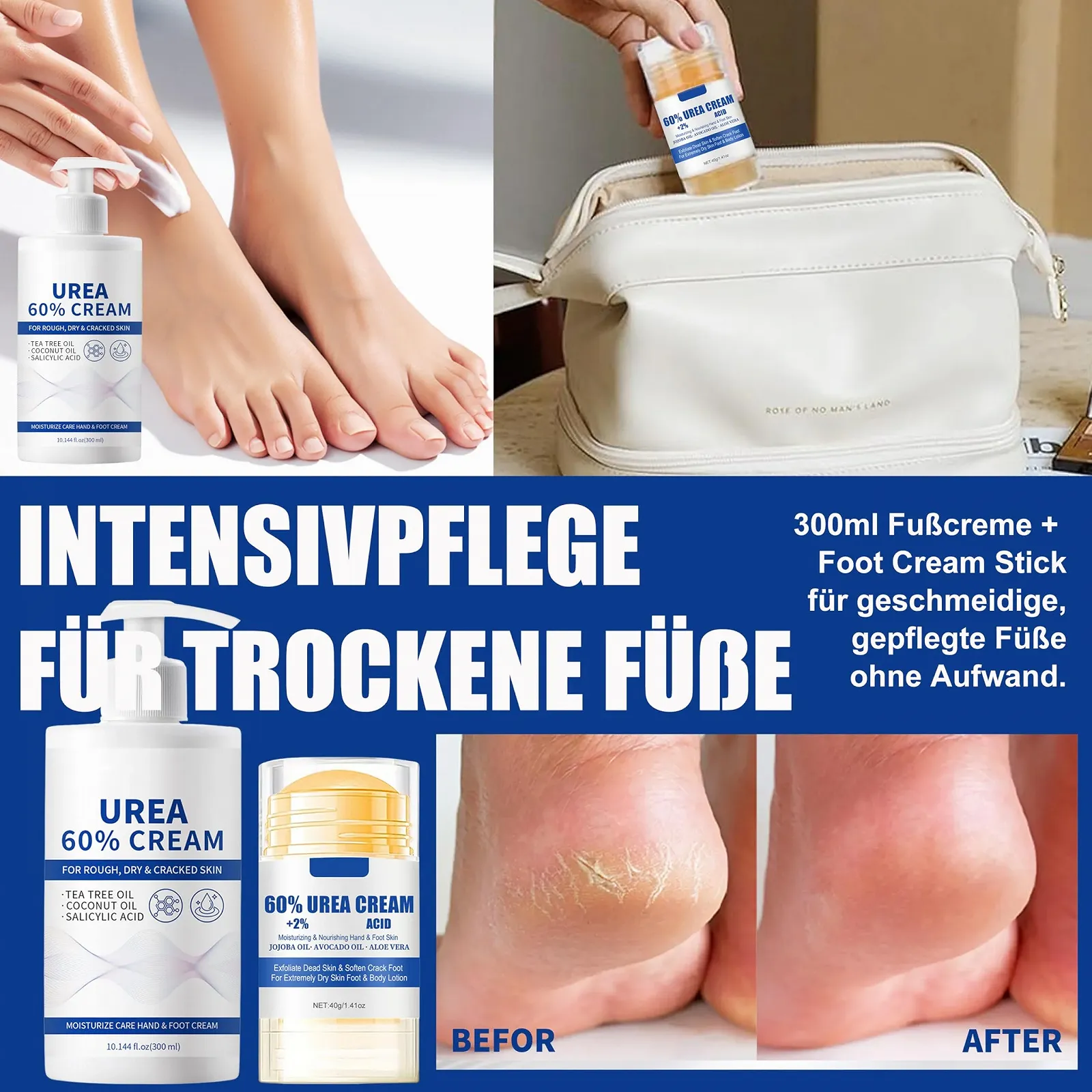 Набор для ухода за ногами 60% Urea Крем и Стик увлажняющий против трещин Aloe Vera XL 300 мл, фото №2