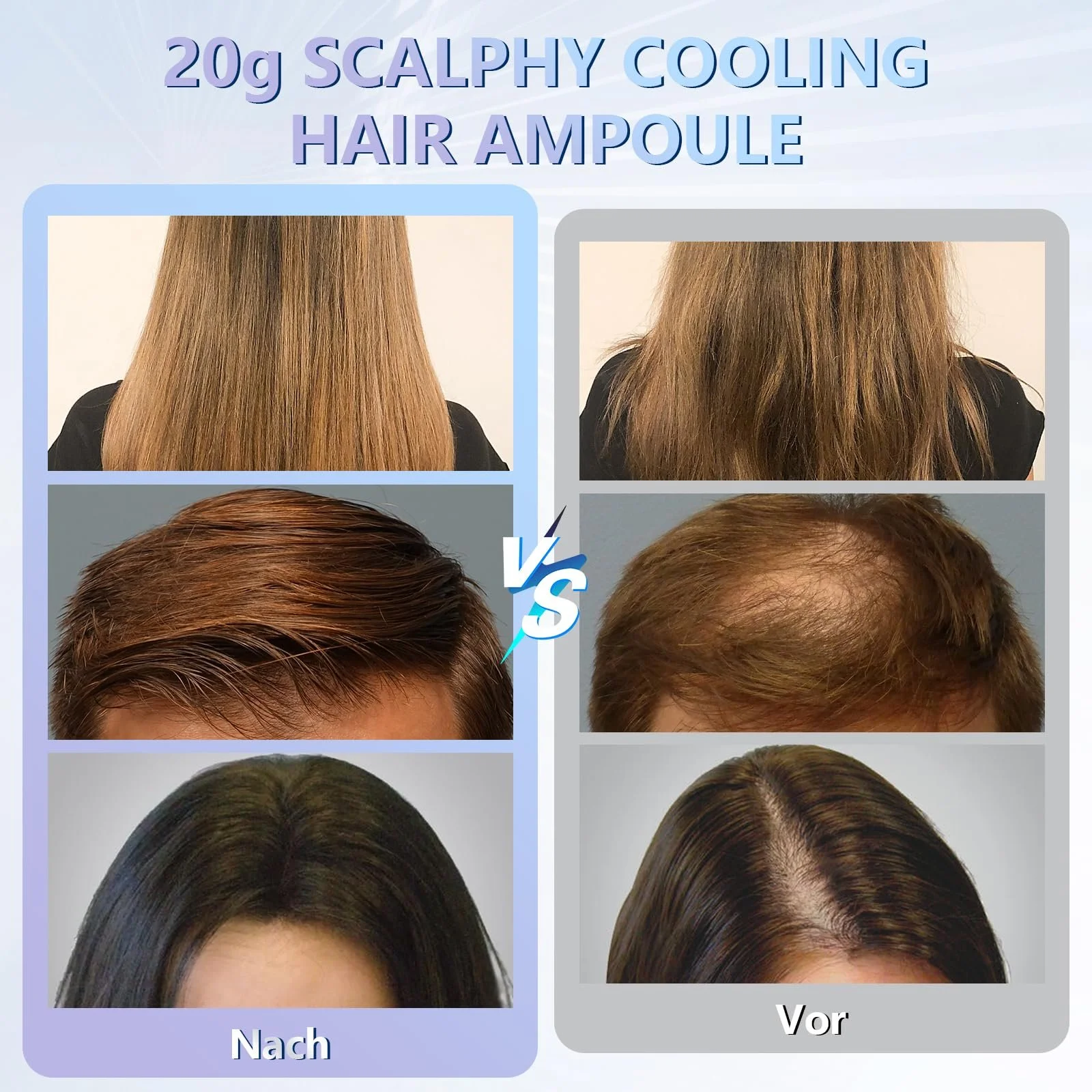 Ампула для волосся Scalphy Охолоджуюча 20 г, фото №7