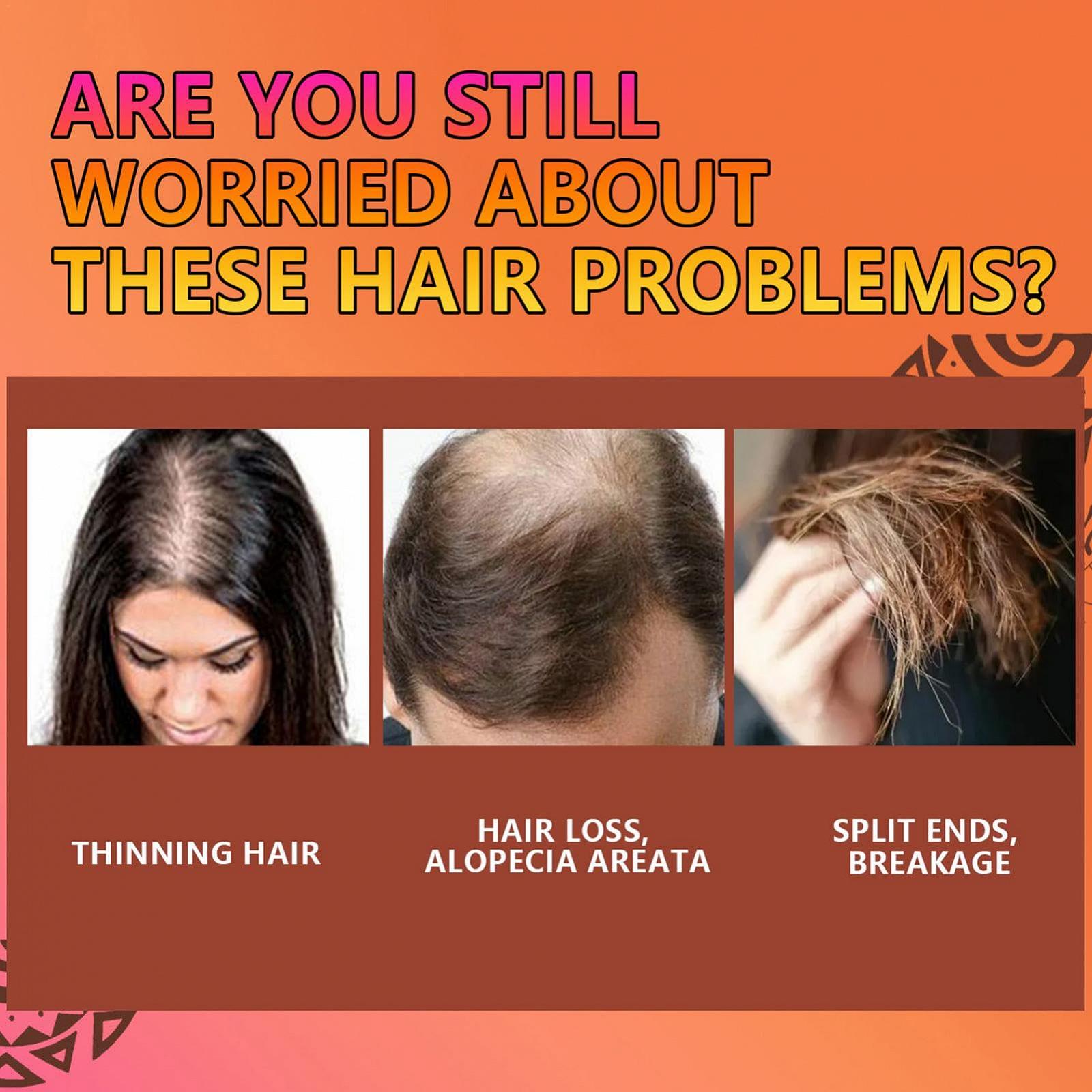 Шампунь Мило Яйце, фото №4 Шампунь Мило Яйце, фото №4