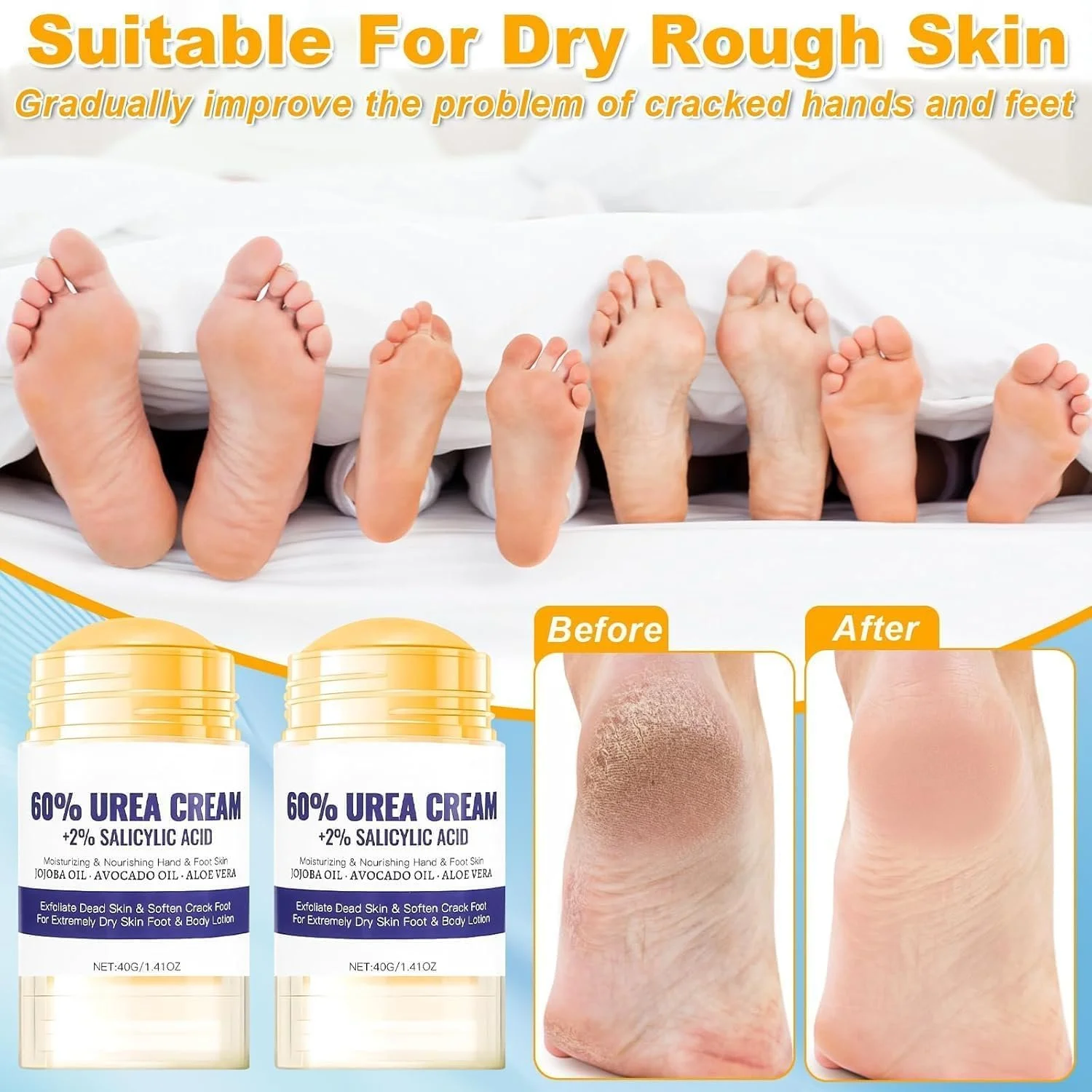 Крем для ног увлажняющий с мочевиной 60% от мозолей и трещин, фото №4