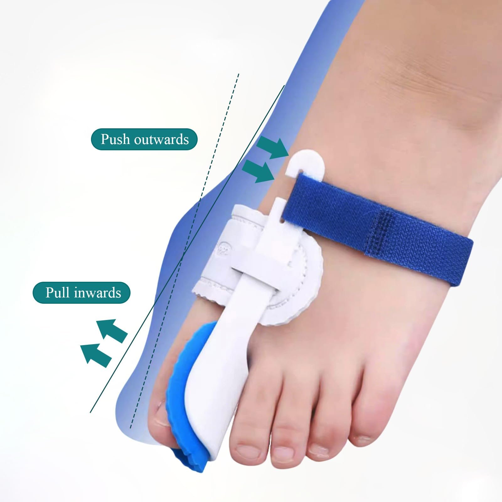 Коректор Hallux Valgus для пальців ніг, бандаж для полегшення болю при вальгусній деформації, фото №2