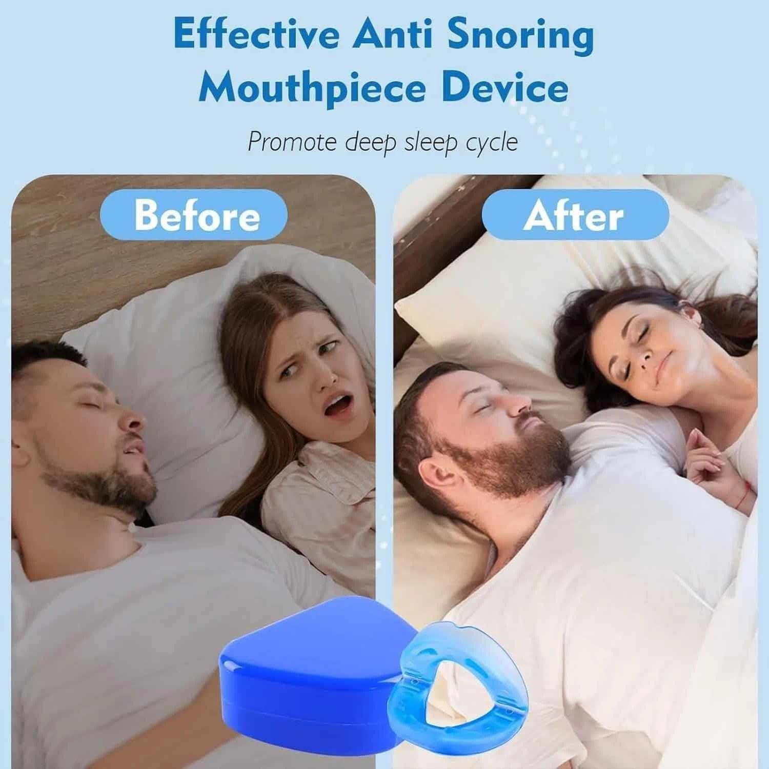 Ротовой Аппарат против Храп Honex Универсальный Размер, фото №4 Ротовой Аппарат против Храп Honex Универсальный Размер, фото №4