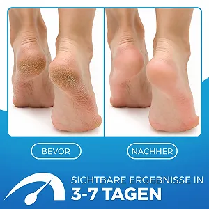 Крем для ног 2-in-1 увлажняющий для потрескавшейся кожи 75 мл. synthetic.ua - Фото 1