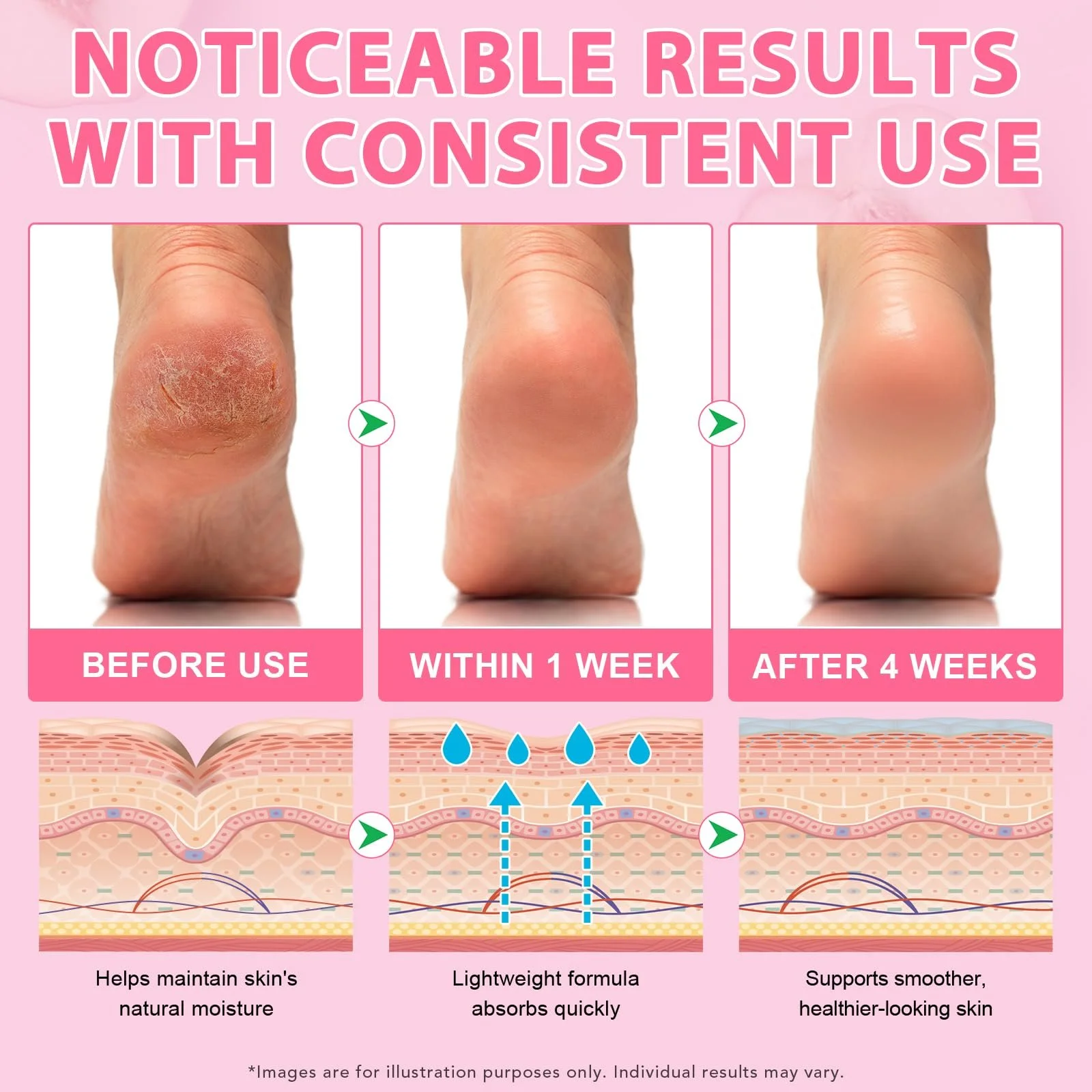 Стик-бальзам для восстановления пяток Cracked Heel Repair Smooth Peach Taste с мочевиной и салициловой кислотой увлажняющий, фото №6