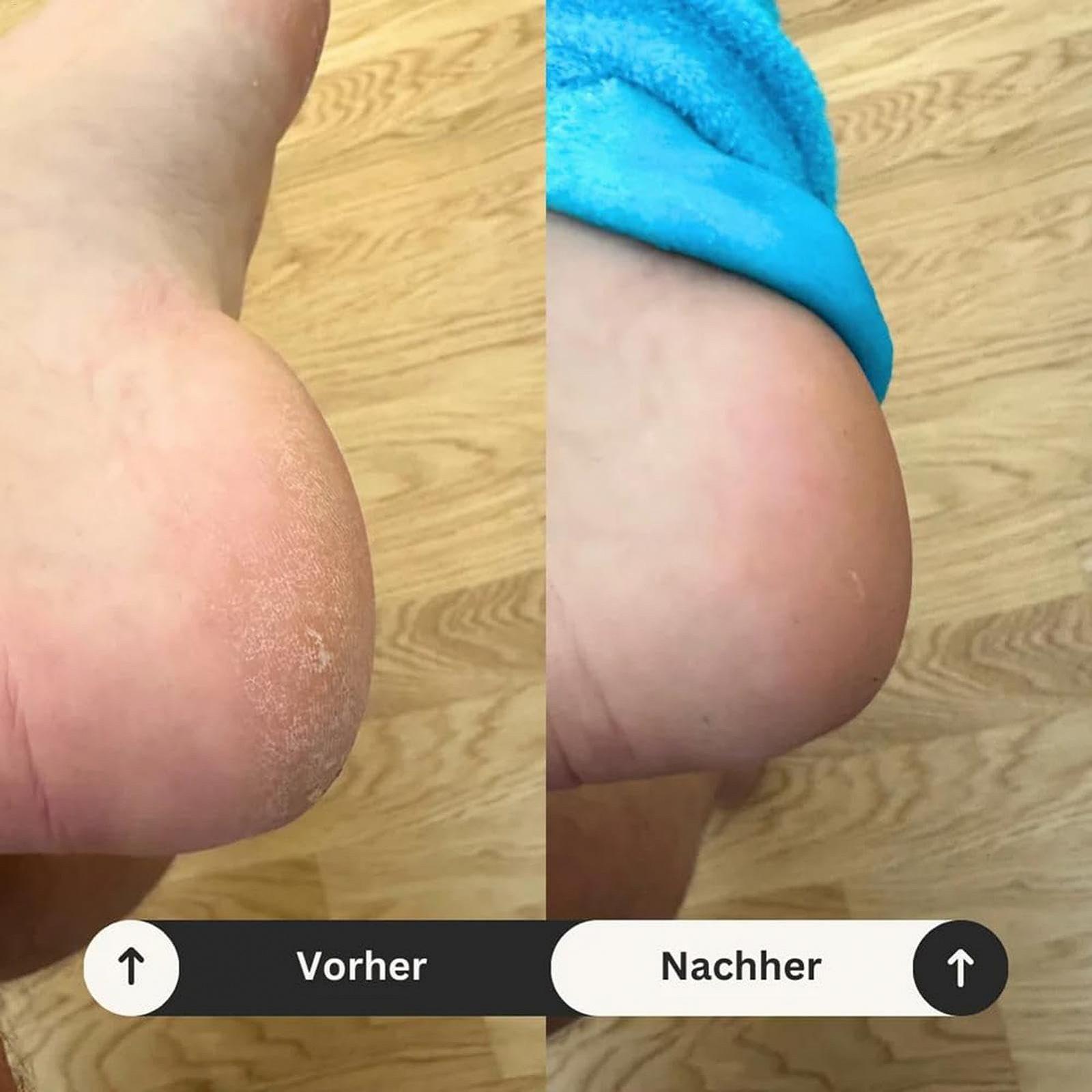 Шкарпетки для ніг від тріщин на п'ятах зволожувальні жіночі 2 шт., фото №5