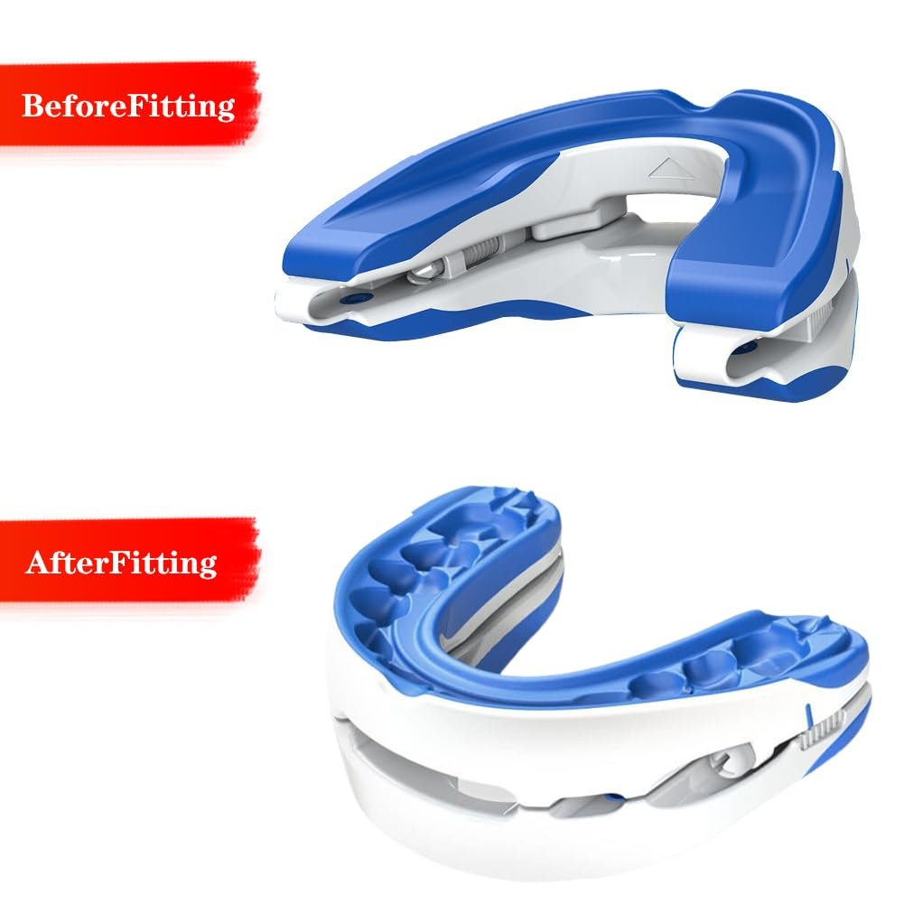 Пристрій від хропіння CEWROM, фото №5 Пристрій від хропіння CEWROM, фото №5