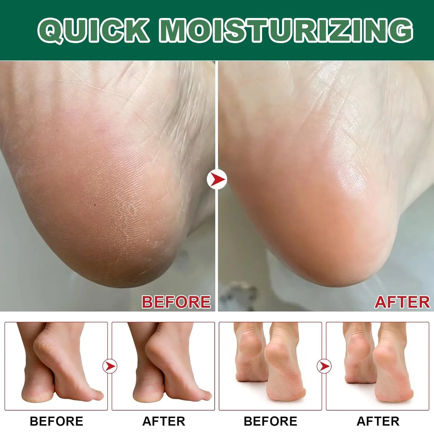 Крем для ног увлажняющий с чайным деревом против трещин и мозолей 100 г, фото №4