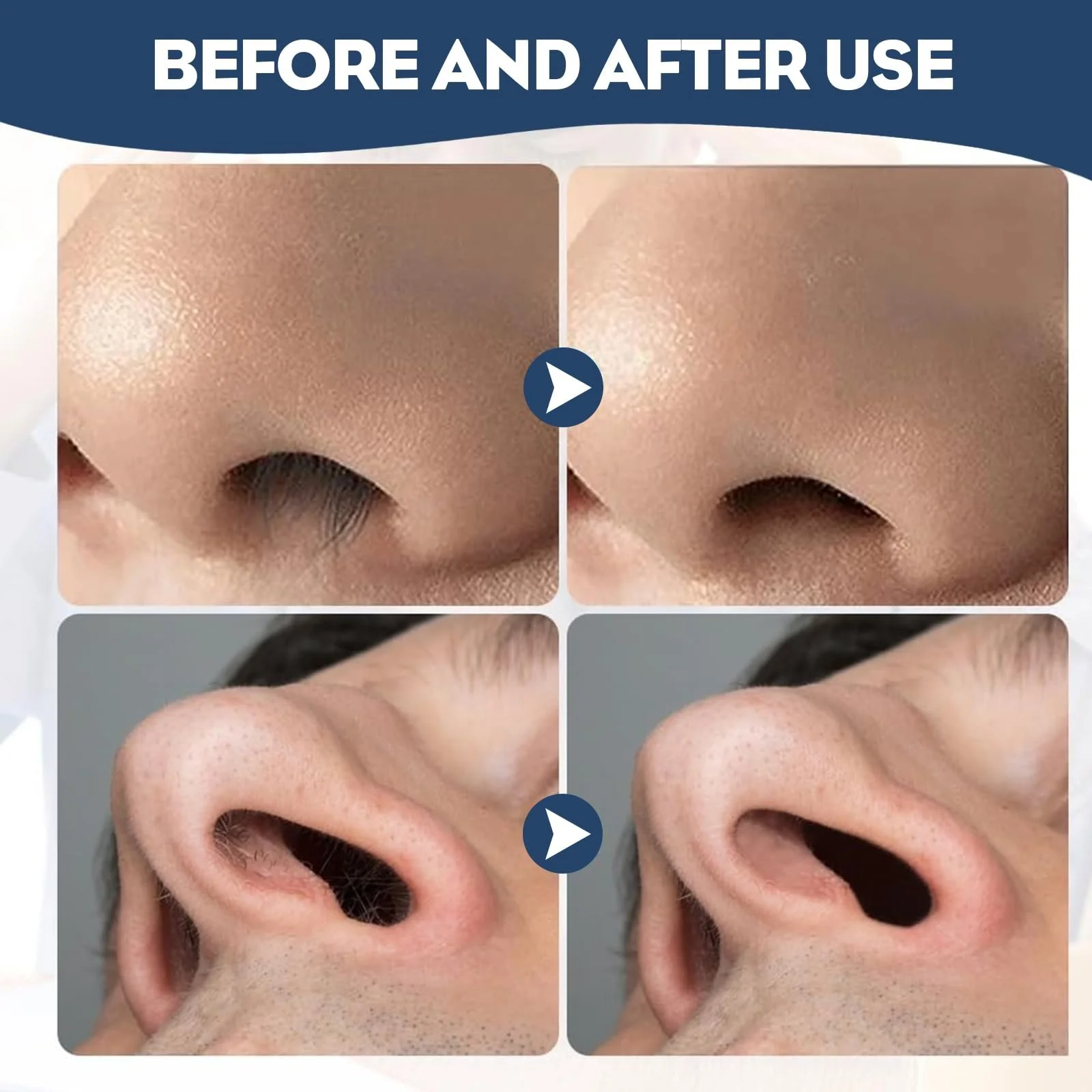 Набор SoeUyd 5 Нож для волос в носу 2-в-1 Двойной с двусторонним лезвием, фото №7