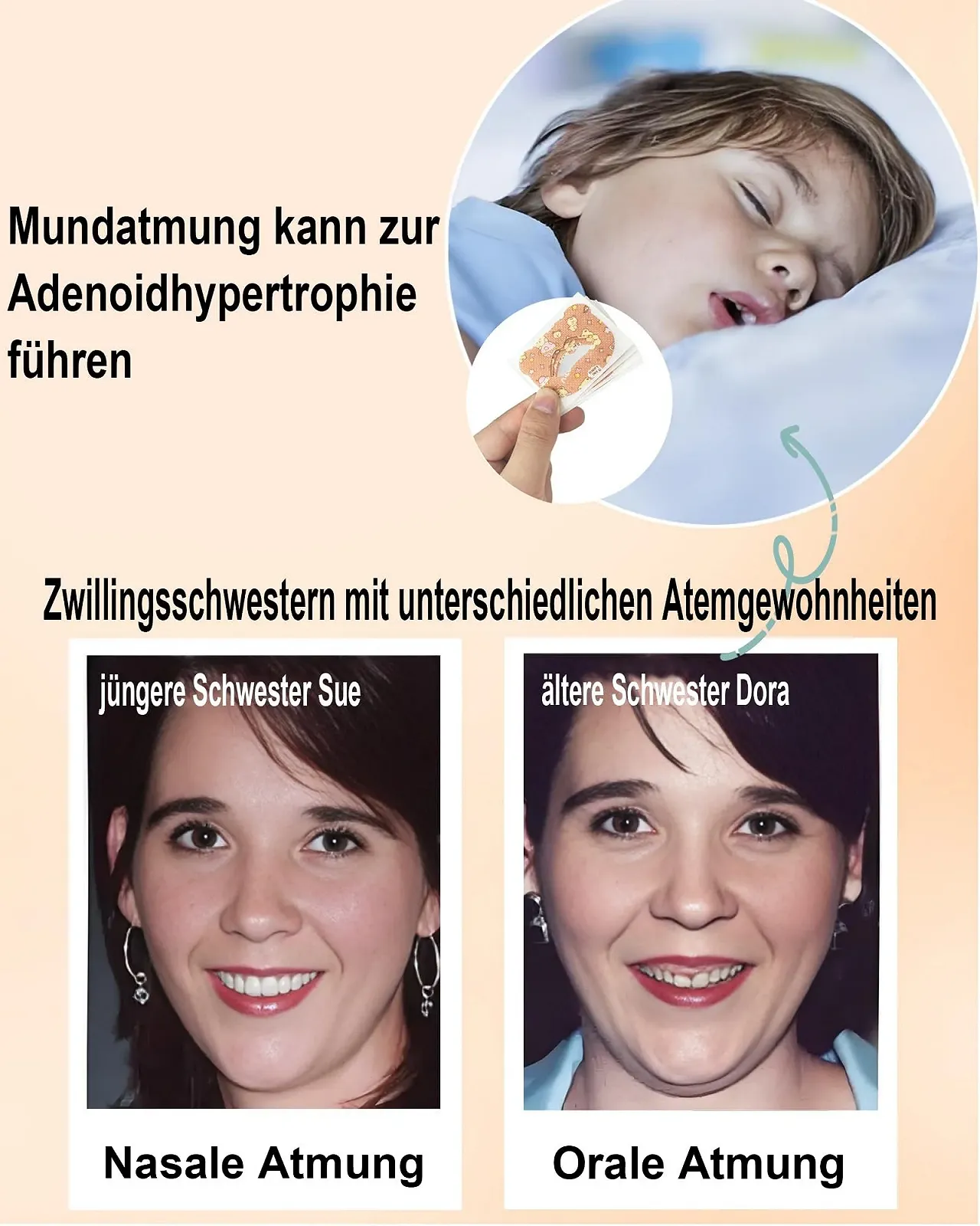 Пластырь для рта для детей для сна, избегание аденоидного лица, преодоление дыхания ртом., фото №4 Пластырь для рта для детей для сна, избегание аденоидного лица, преодоление дыхания ртом., фото №4