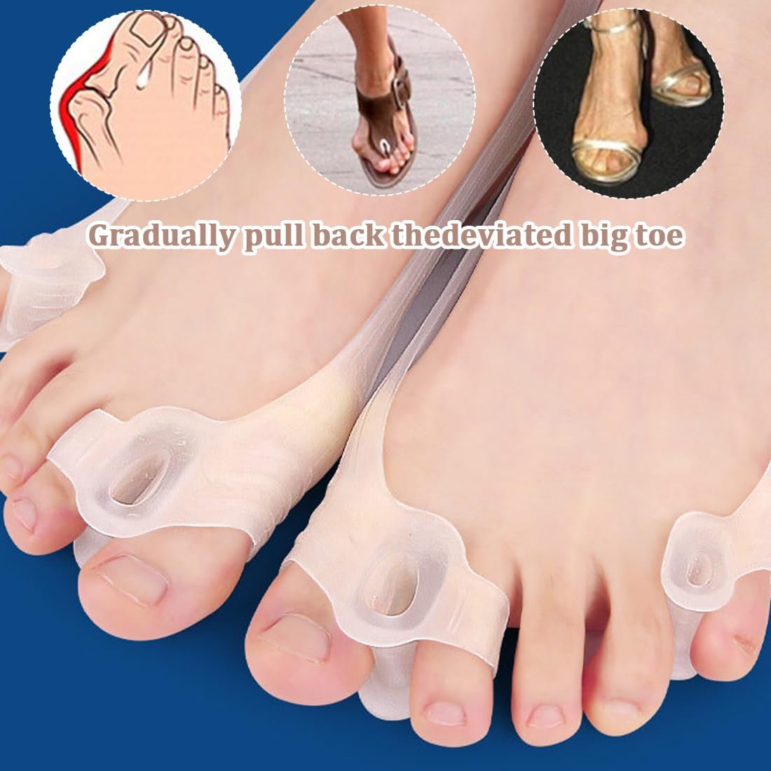 Шина для великого пальця стопи Силіконовий роздільник пальців Ортопедичний, фото №6