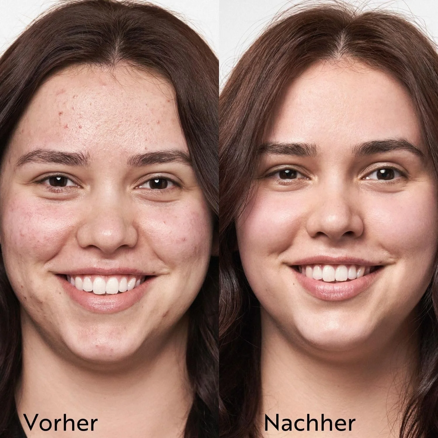 Маска для обличчя M. Asam Clear Skin Очищуюча 100 мл, фото №3 Маска для обличчя M. Asam Clear Skin Очищуюча 100 мл, фото №3