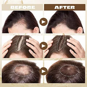 Сыворотка для роста волос для мужчин и женщин, средство для контроля выпадения волос, ускоряет рост волос, масло для густых волос, сыворотка для питания кожи головы synthetic.ua - Фото 1