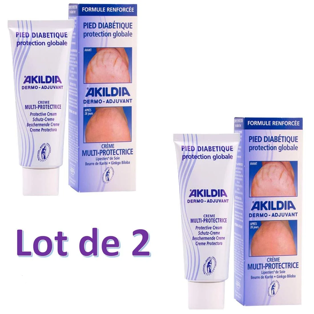 Крем для диабетической стопы Akildia 75 мл, фото №1