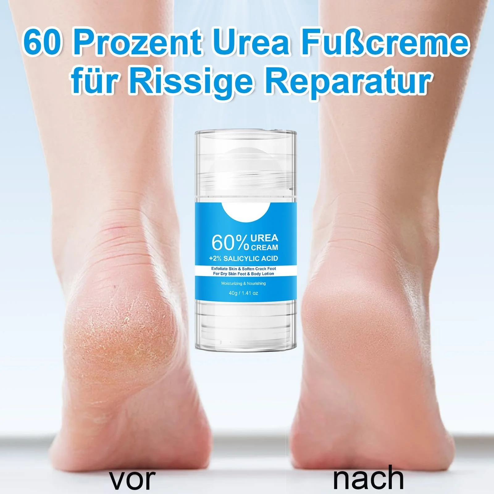 Крем для ног с мочевиной 60% и салициловой кислотой 2% против мозолей 2 шт., фото №6