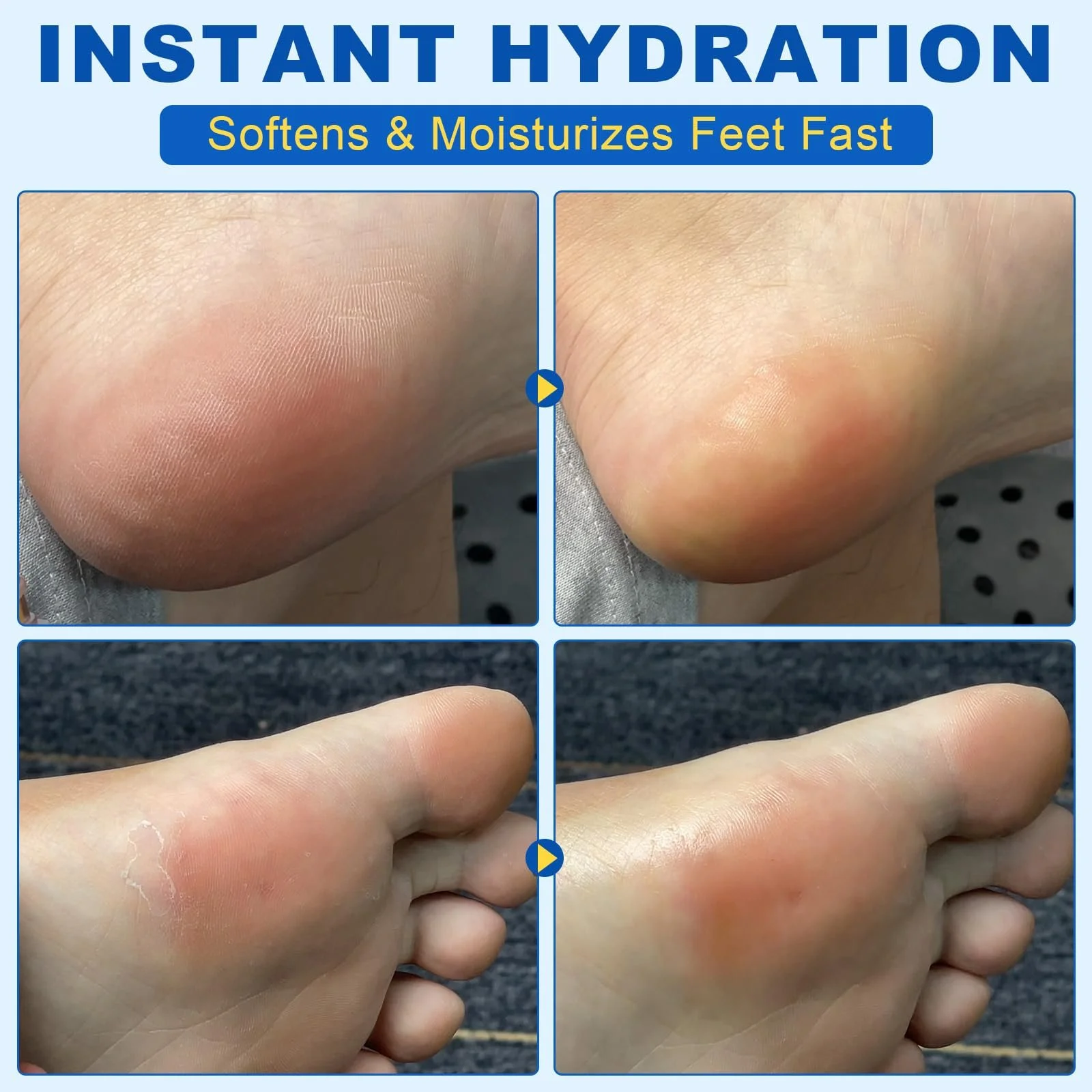 Крем для ног Urea Cream 60% интенсивный от мозолей и трещин в стике, фото №5