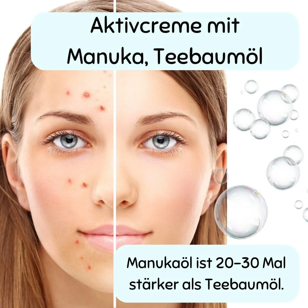 Крем для обличчя Green idea Manuka Acne проти прищів з олією чайного дерева та манукою 50 мл, фото №4 Крем для обличчя Green idea Manuka Acne проти прищів з олією чайного дерева та манукою 50 мл, фото №4