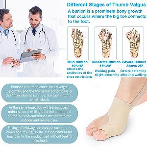 Коректор великого пальця стопи для жінок та чоловіків, шина для корекції вальгусної деформації synthetic.ua - Фото 1