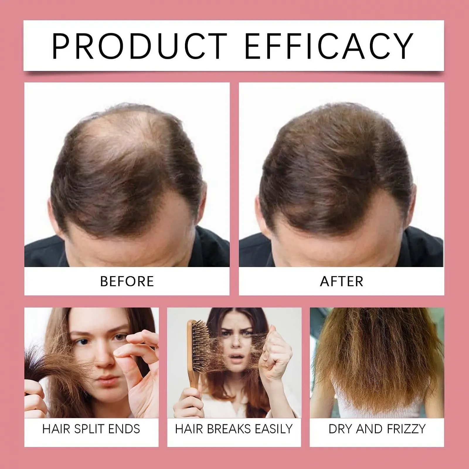 Спрей для роста волос, 50 мл, фото №6