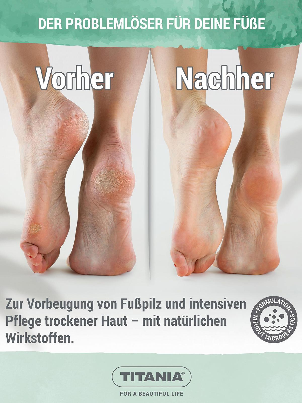 Захисний крем проти грибка стопи TITANIA з олією чайного дерева, розмарином та мигдальною олією, 75 мл, фото №4