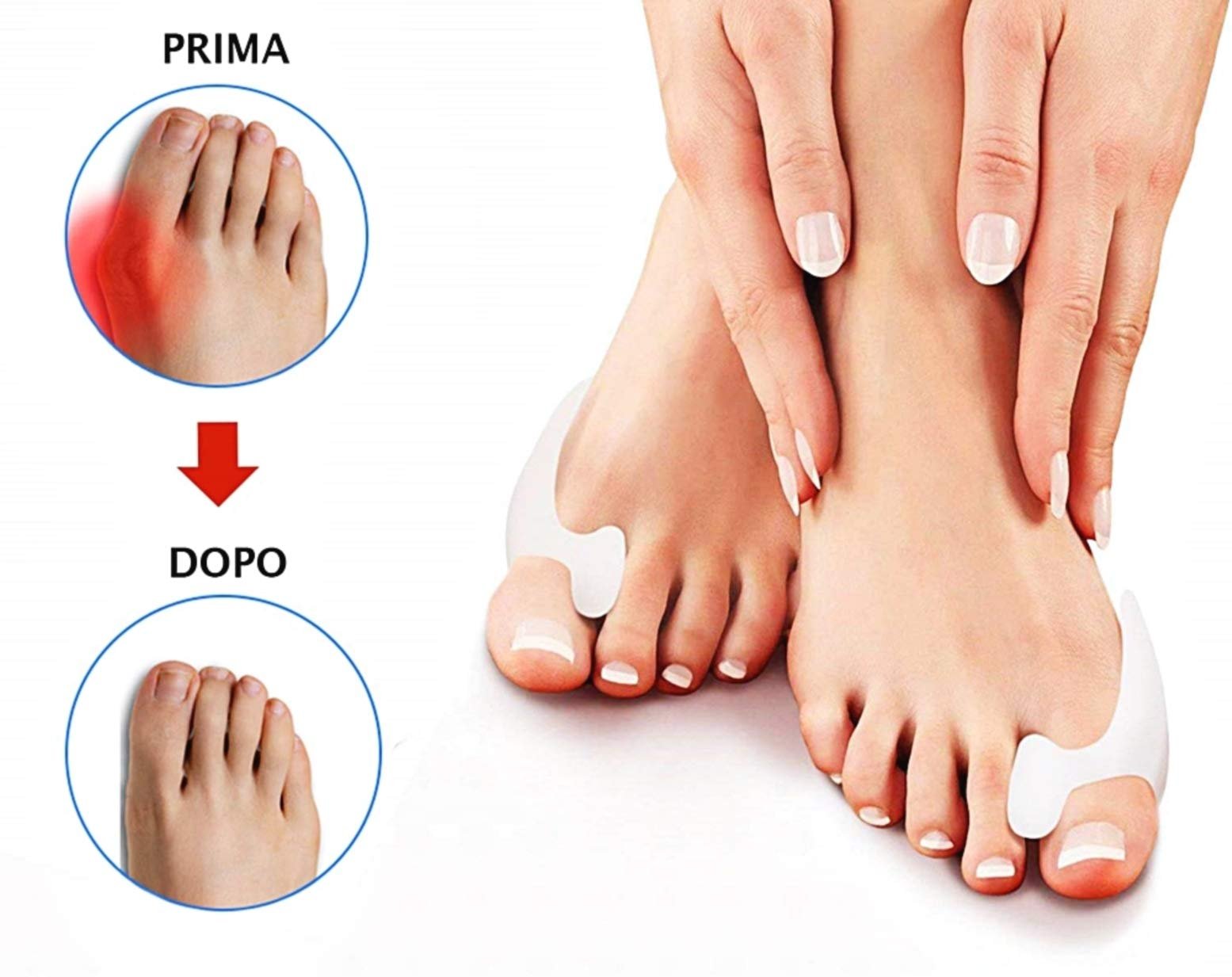 Коректор Hallux Valgus Гель Медичний Силікон 6 штук Бежевий, фото №4