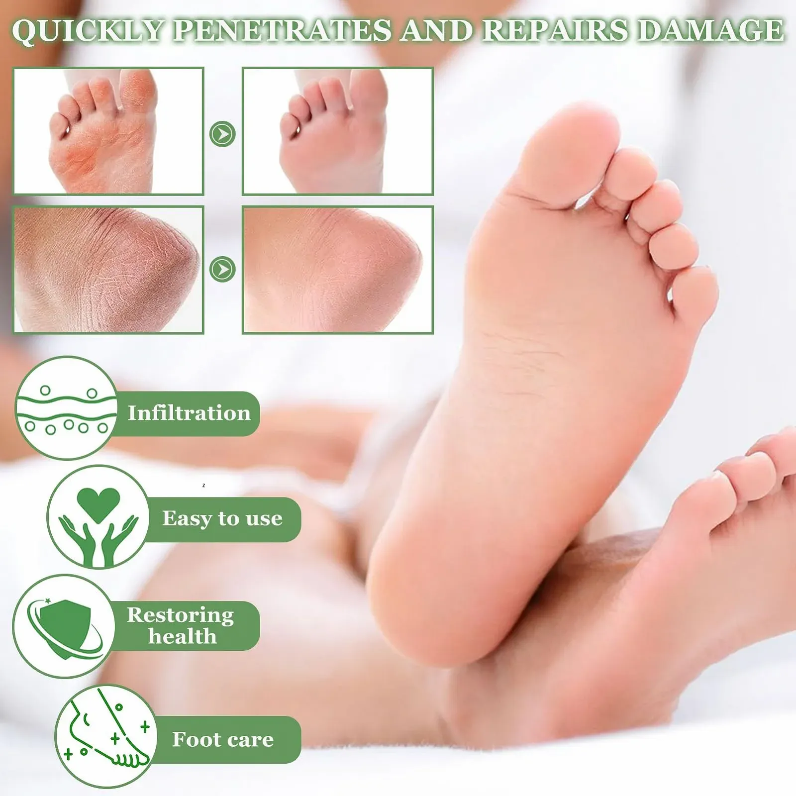 Крем для ног и рук Urea Cream 40% мочевины и 2% салициловой кислоты с алоэ вера, 60 г, фото №6