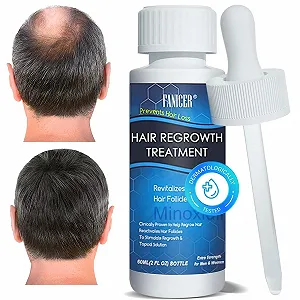 Купити Сироватка для росту волосся 60 мл, діє проти витончення волосся - Фото 1 Сироватка для росту волосся 60 мл, діє проти витончення волосся - Фото 1