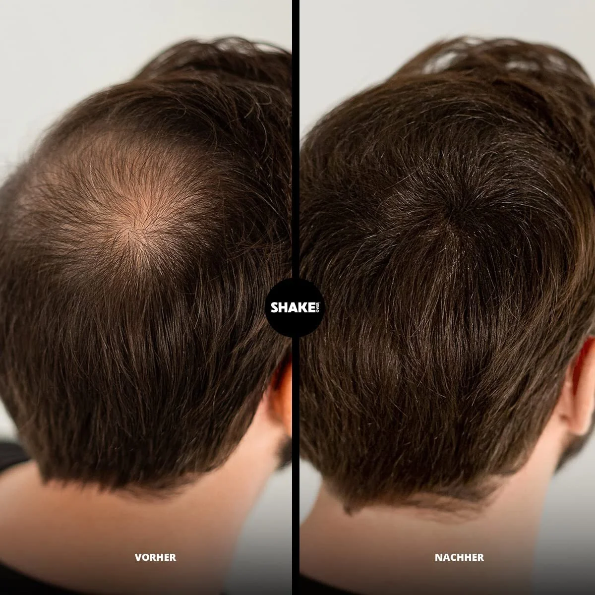 Волосся, що загущує, SHAKE OVER Vegan з волокнами, збагаченими цинком 30 г, Попелястий блонд, фото №5