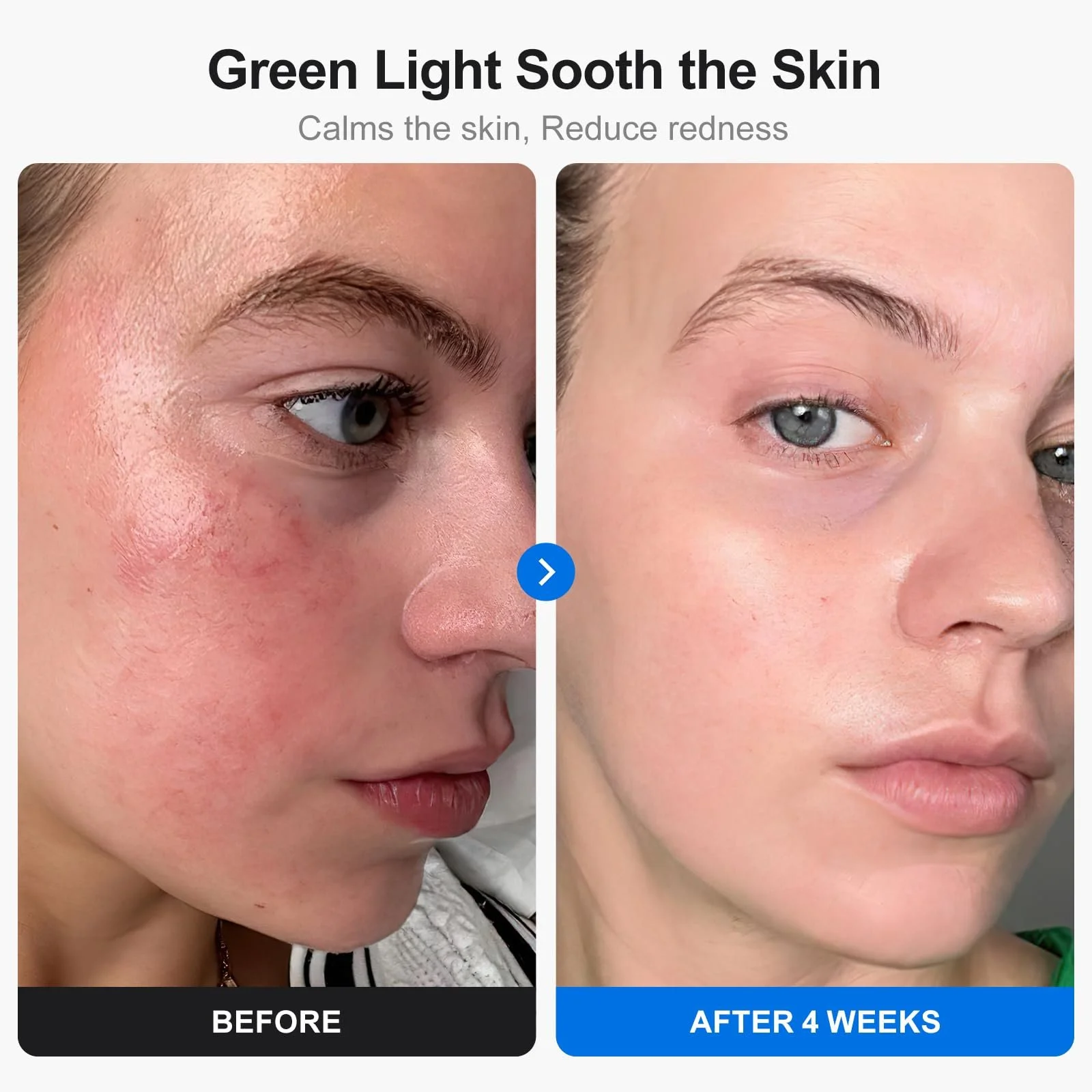 LED Маска для лица Profey 7 цветов, Маска с красным светом, для омоложения кожи и против морщин, фото №4 LED Маска для лица Profey 7 цветов, Маска с красным светом, для омоложения кожи и против морщин, фото №4