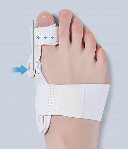 Коректор великого пальця стопи для чоловіків і жінок Ортопедична шина synthetic.ua - Фото 1