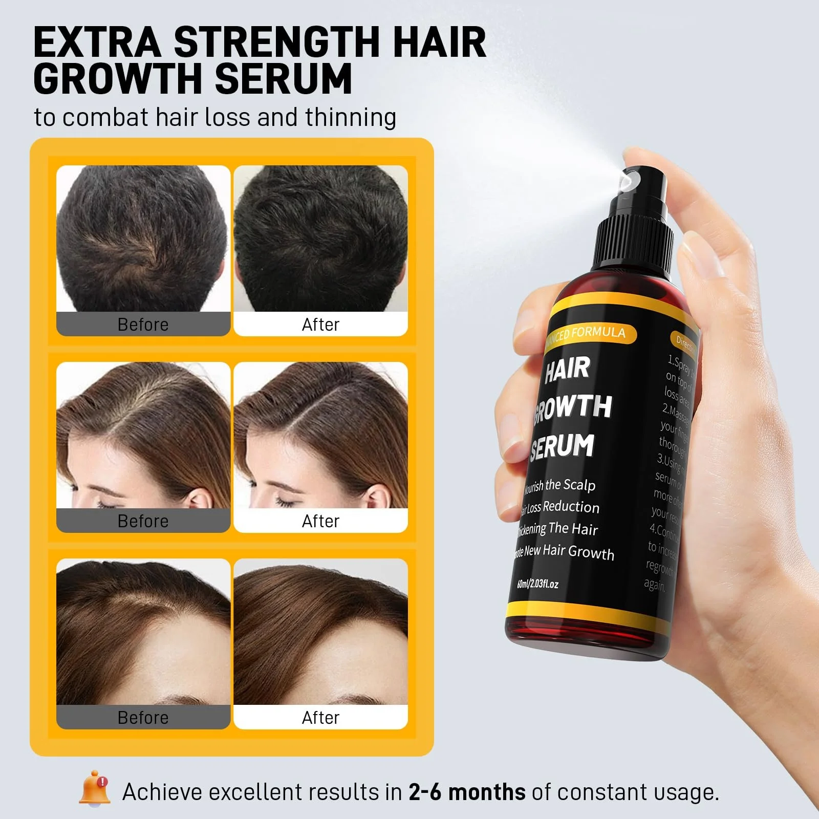 Сироватка для росту волосся YaaHei, 2 шт. по 60 мл, фото №5