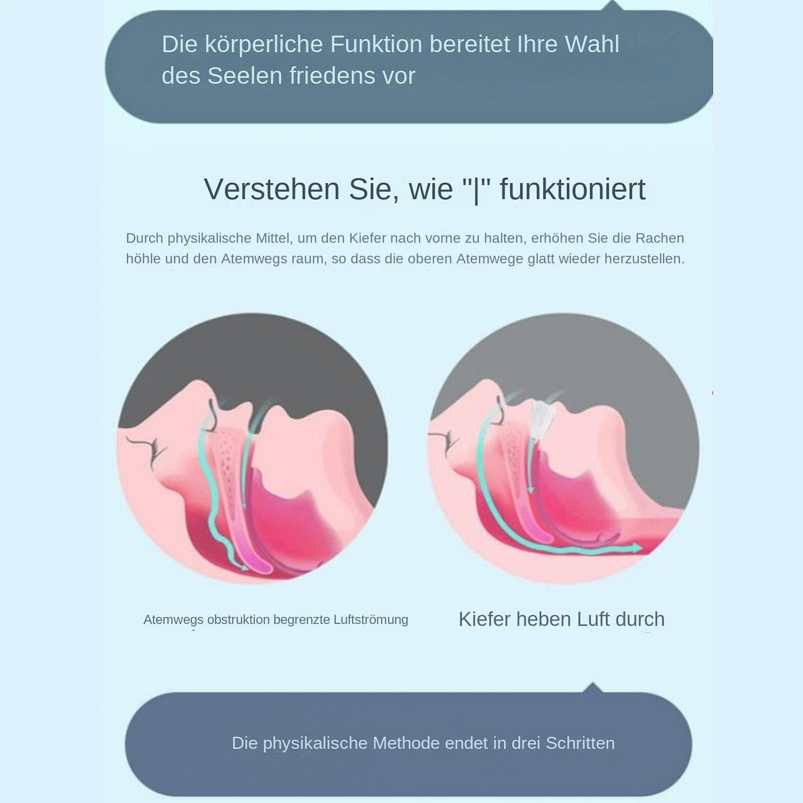 Капа от храпа, фото №5