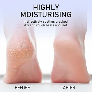 Крем для ног KYDA увлажняющий против трещин 2 шт 4.5 oz synthetic.ua - Фото 1