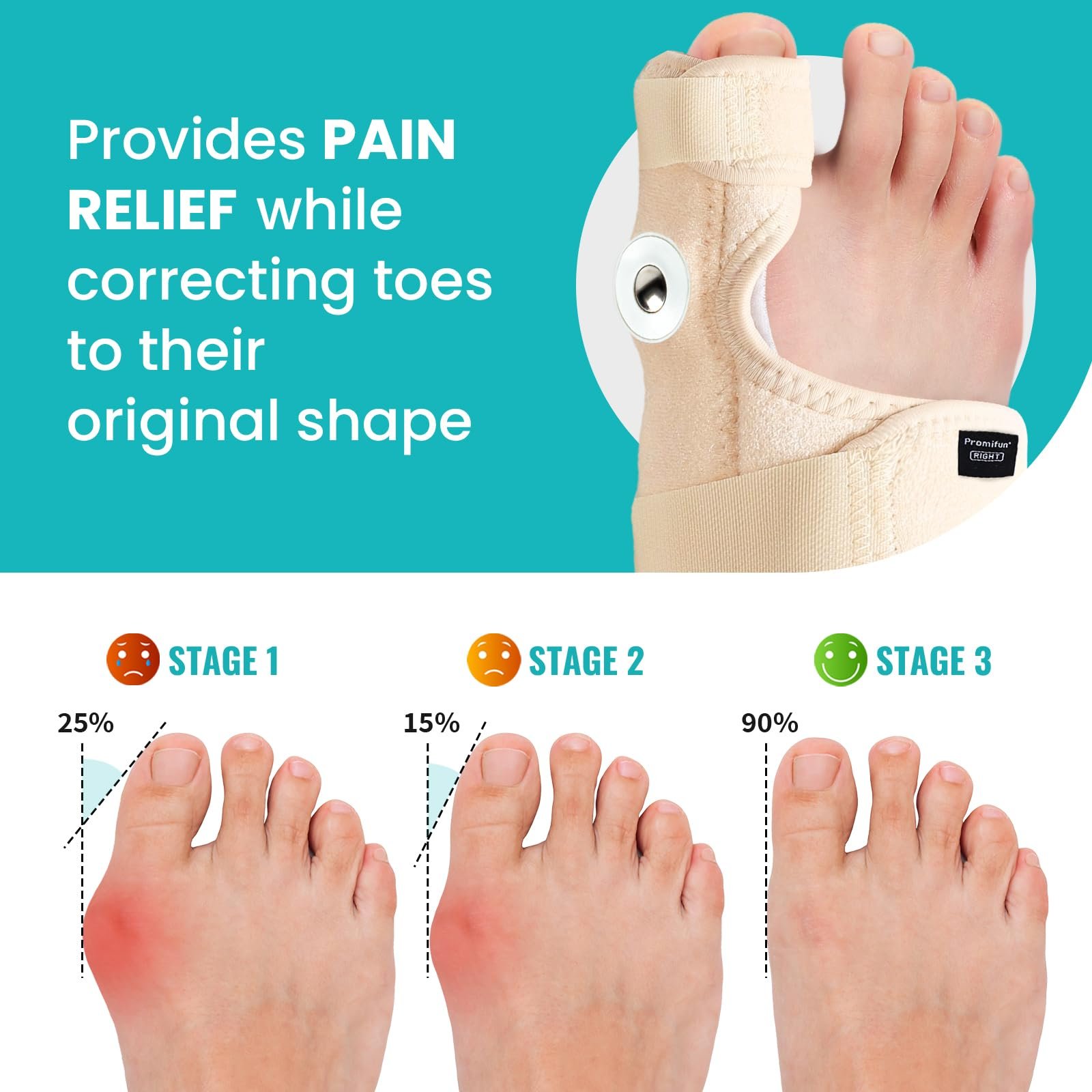 Корректор большого пальца стопы Promifun, регулируемый, бежевый, 1 пара, фото №2 Корректор большого пальца стопы Promifun, регулируемый, бежевый, 1 пара, фото №2