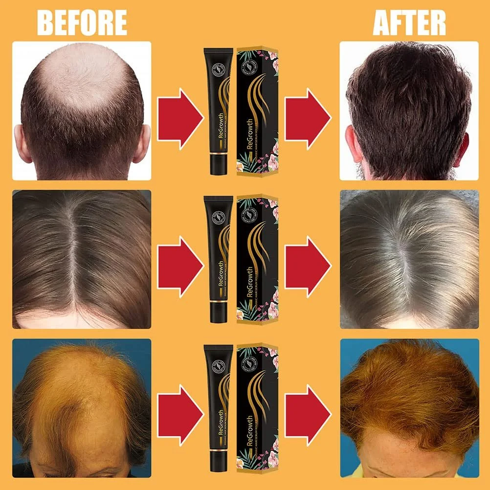 Сироватка для росту волосся Roll-on Enkomy, з роликом, запобігає випадінню волосся, фото №6